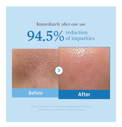 Limpiador en aceite medicube zero pore pieles mixtas - grasas