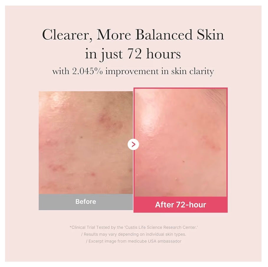 Serum de ácido tranexamico y niacinamida medicube