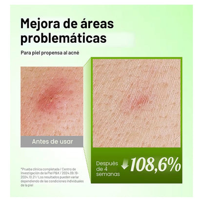 Serum de ácido azelaico anua para pieles con tendencia acneica